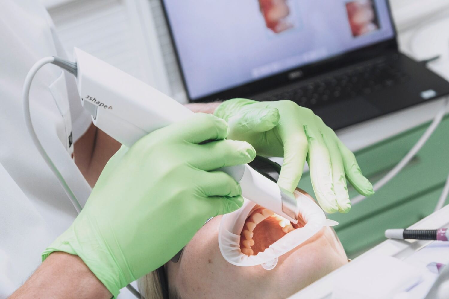 Prosthetics