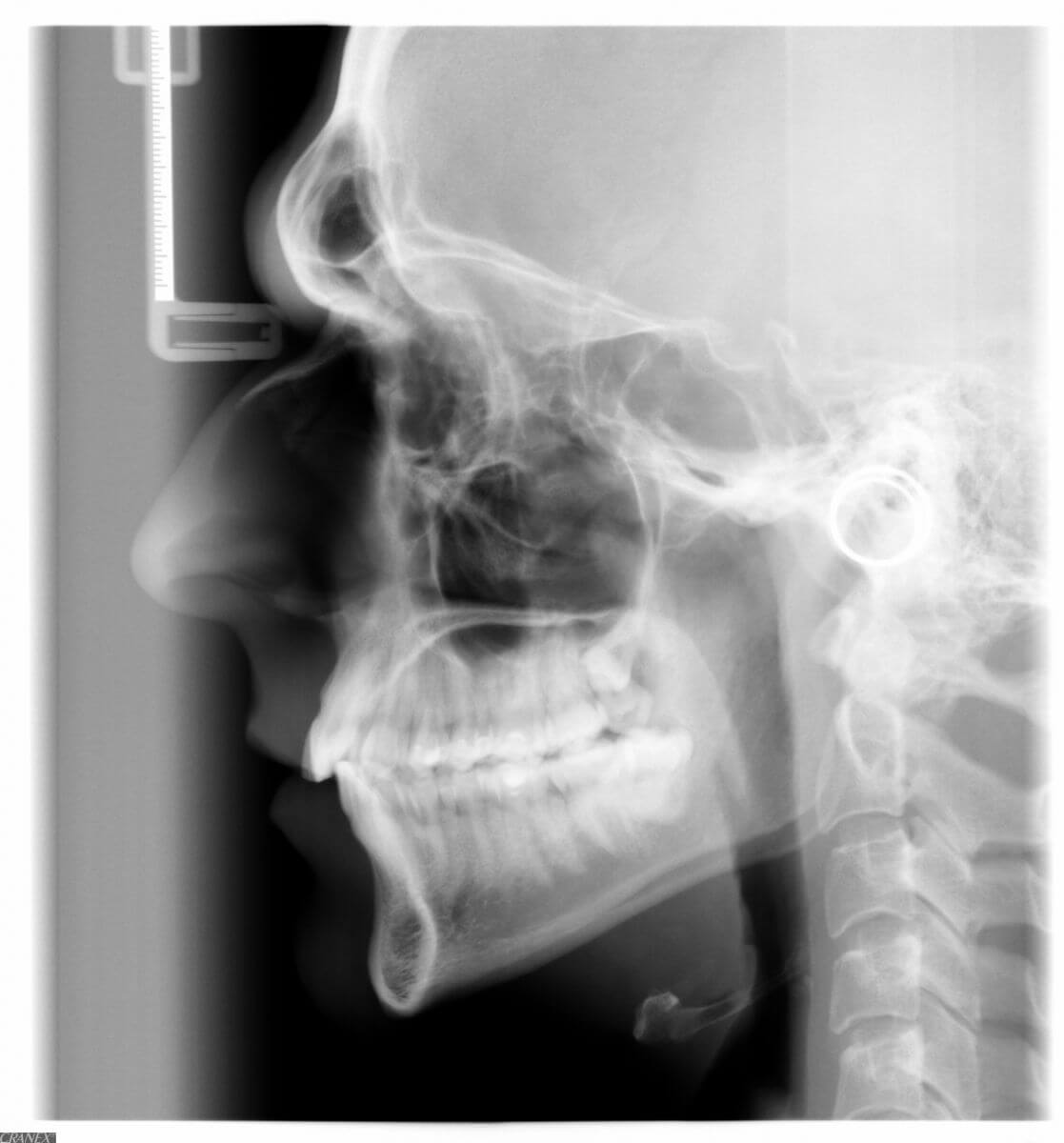 рентген с членом во рту фото 74